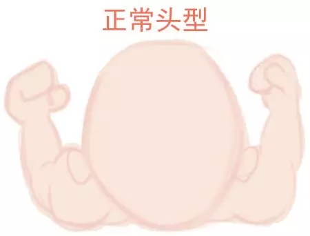 ԲͷվɱͷЩ趼֪1.webp.jpg