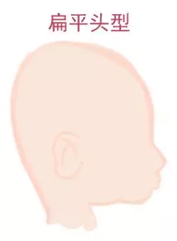 ԲͷվɱͷЩ趼֪4.webp.jpg
