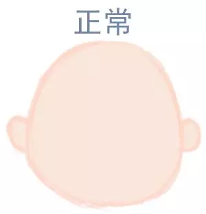 ԲͷվɱͷЩ趼֪5.webp.jpg
